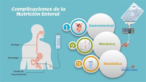 Alimentación enteral