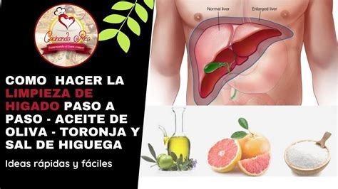 Alimentos para la limpieza del hígado