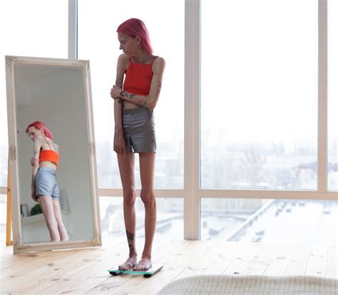 Anorexia en adolescentes
