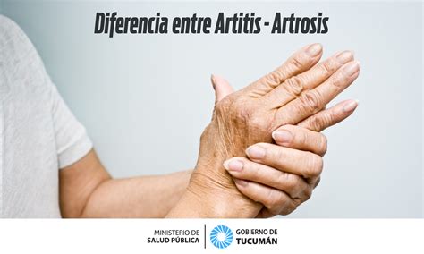 Artrosis