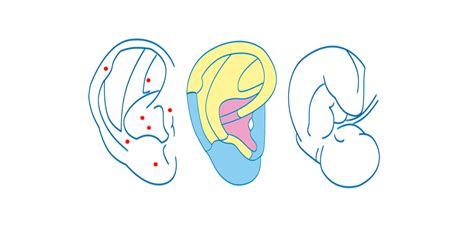 Auriculoterapia y el cuerpo
