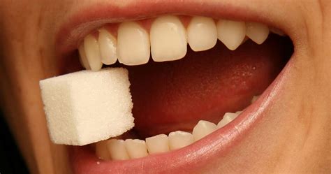 Azúcar y Caries