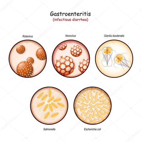 Bacterias causantes de diarrea