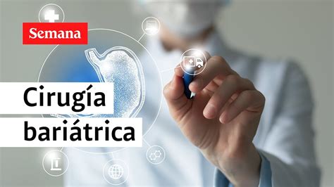 Beneficios de la Cirugía Bariátrica