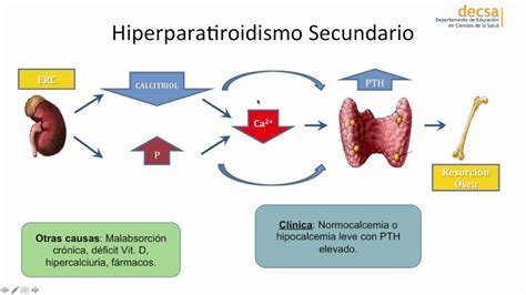 Cambios óseos en hiperparatiroidismo