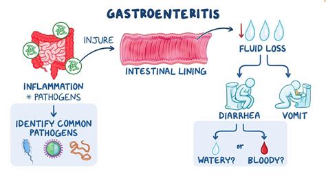 Ciclo de la Gastroenteritis