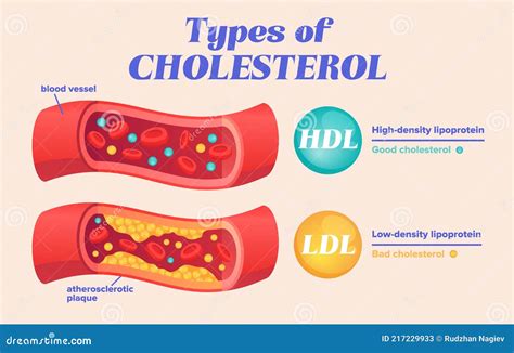 Colesterol HDL y LDL