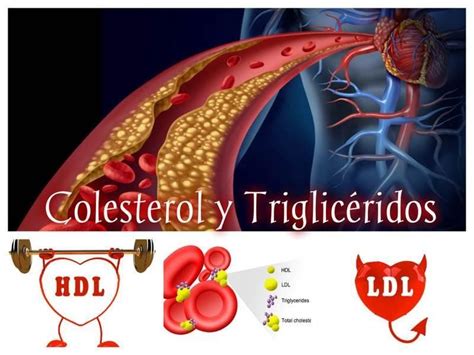 Colesterol y trigliceridos