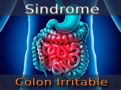 Colon Irritable