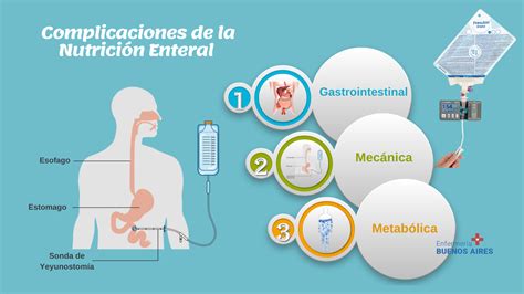 Complicaciones de la Nutrición Parenteral