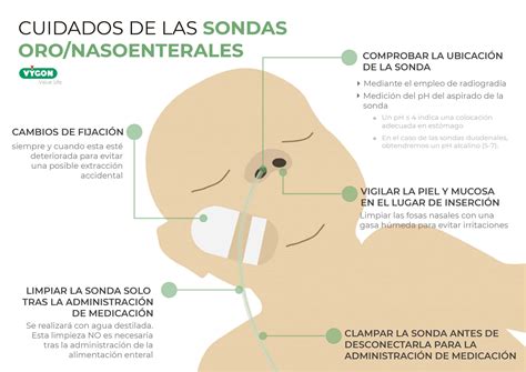 Cuidado de la sonda de alimentación