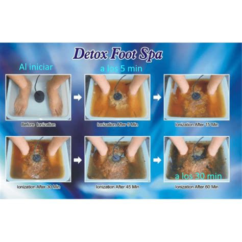 Desintoxicador Iónico Quantum