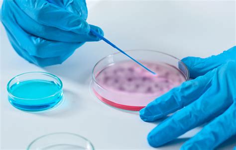Diagnóstico de Candidiasis