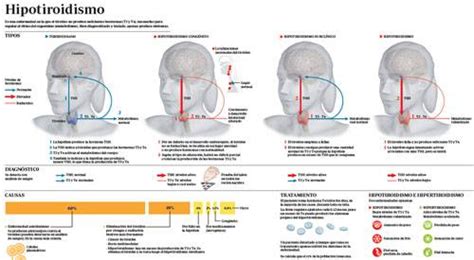 Diagnóstico de Tiroiditis de Hashimoto