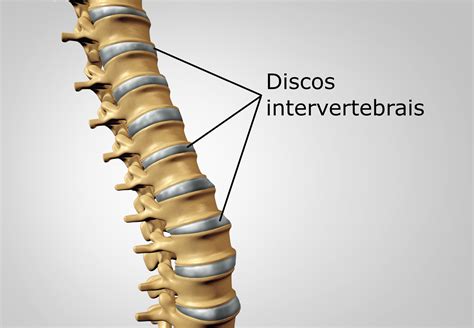 Disco Intervertebral