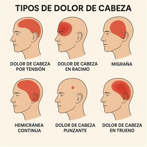 Dolor de cabeza