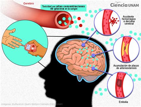 Efectos del Azúcar en el Cerebro