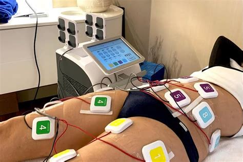 Electroestimulación Muscular