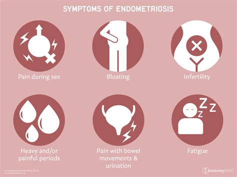 Endometriosis