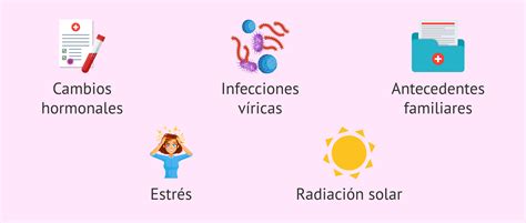 Factores de riesgo del Lupus
