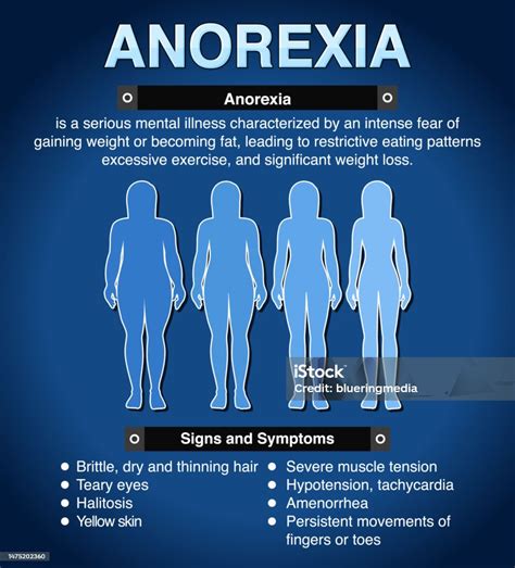 Fases de la anorexia