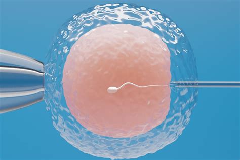 Fecundación In Vitro