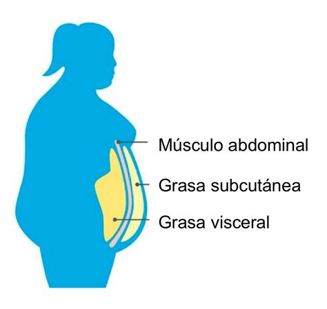 Grasa Visceral vs. Subcutánea