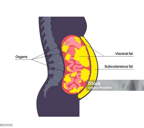 Grasa visceral