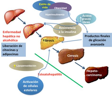 Hits de la patogenia de la enfermedad de hígado graso no-alcohólica (EHGNA)