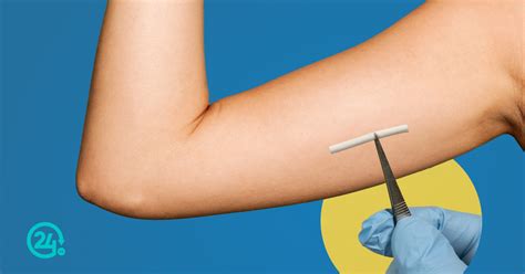 Implantes subcutáneos