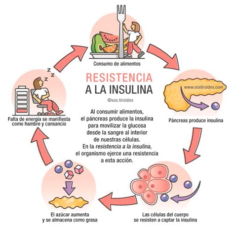 Infografía de alimentos para la resistencia a la insulina