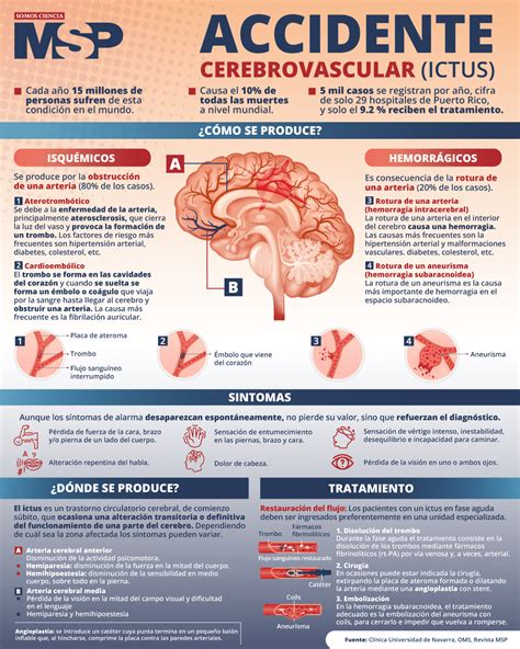 Infografía sobre el accidente cerebrovascular