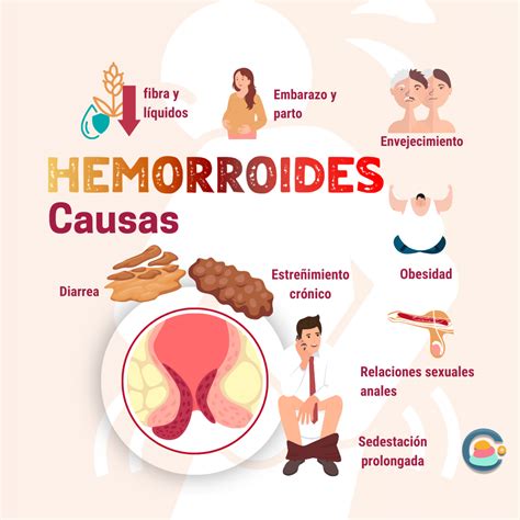 Infografía sobre hemorroides y dieta