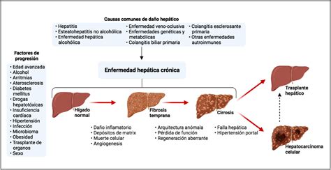Infografía sobre la enfermedad hepática crónica