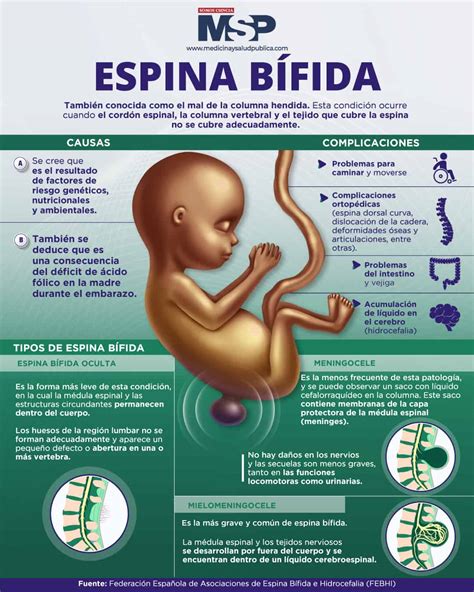 Infografía sobre la espina bífida y el ácido fólico