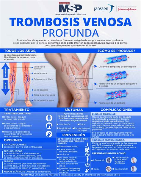 Infografía sobre trombosis venosa profunda
