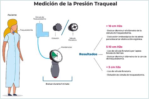 Medición de presión traqueal