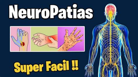 Neuropatias
