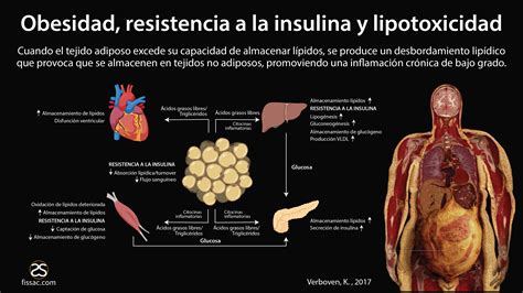 Obesidad y Resistencia a la Insulina