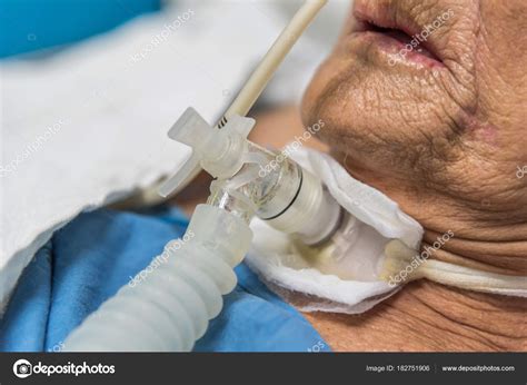 Paciente con traqueostomía