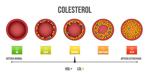 Reducción del Colesterol Total con Orlistat