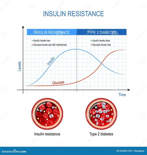 Resistencia a la insulina y diabetes tipo 2