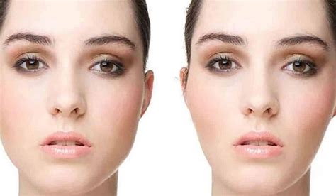 Resultados de la Bichectomía Enzimática PB Serum