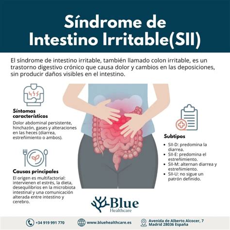 Síndrome de Intestino Irritable