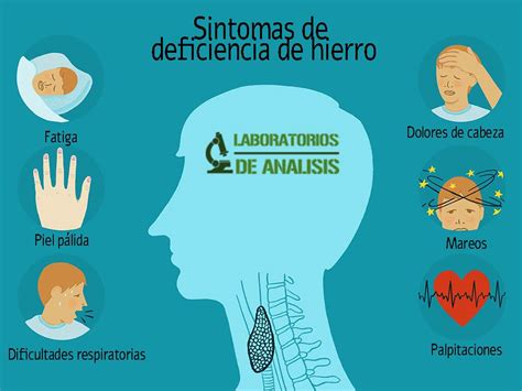 Síntomas de Deficiencia de Hierro