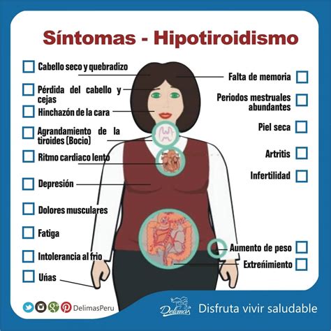 Síntomas del Hipotiroidismo