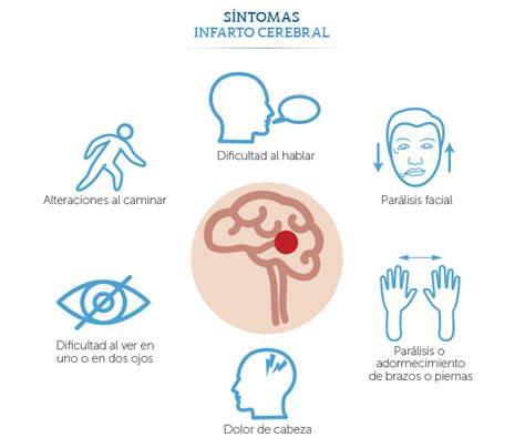 Signos de un ataque cerebral