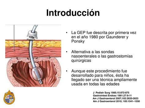 Tabla IV. Indicaciones de gastrostomía endoscópica percutánea (GEP)